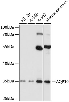 Anti-AQP10 Antibody (CAB2888)