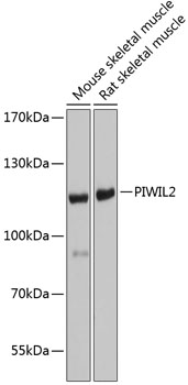 Anti-PIWIL-2 Antibody (CAB6044)