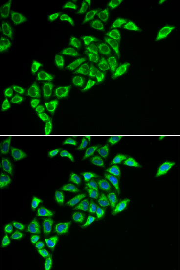 Anti-DLAT Antibody (CAB6288)