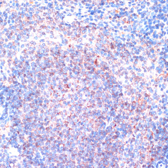 Anti-P90RSK Antibody (CAB15718)