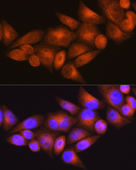 Anti-WFS1 Antibody (CAB1705)