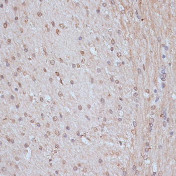 Anti-SNW1 Antibody (CAB14580)