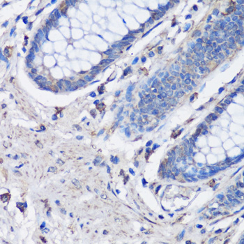 Anti-NLRC4 Antibody (CAB13117)