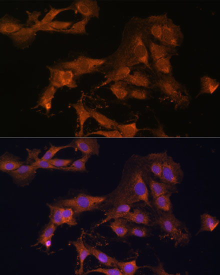 Anti-MAP2K3 Antibody (CAB7718)