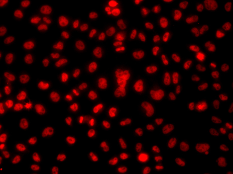 Anti-HNRNPA1 Antibody (CAB7491)