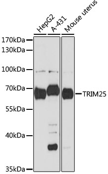 Anti-TRIM25 Antibody (CAB12938)