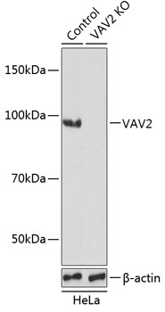 Anti-VAV2 Antibody [KO Validated] (CAB19883)