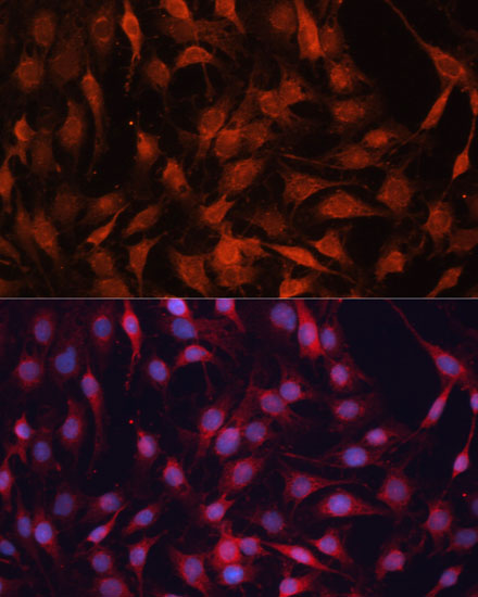 Anti-GNA13 Antibody [KO Validated] (CAB5746)