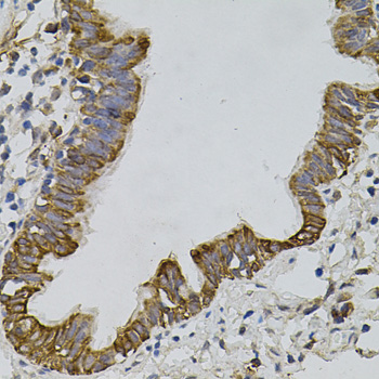 Anti-ARHGEF11 Polyclonal Antibody (CAB7954)