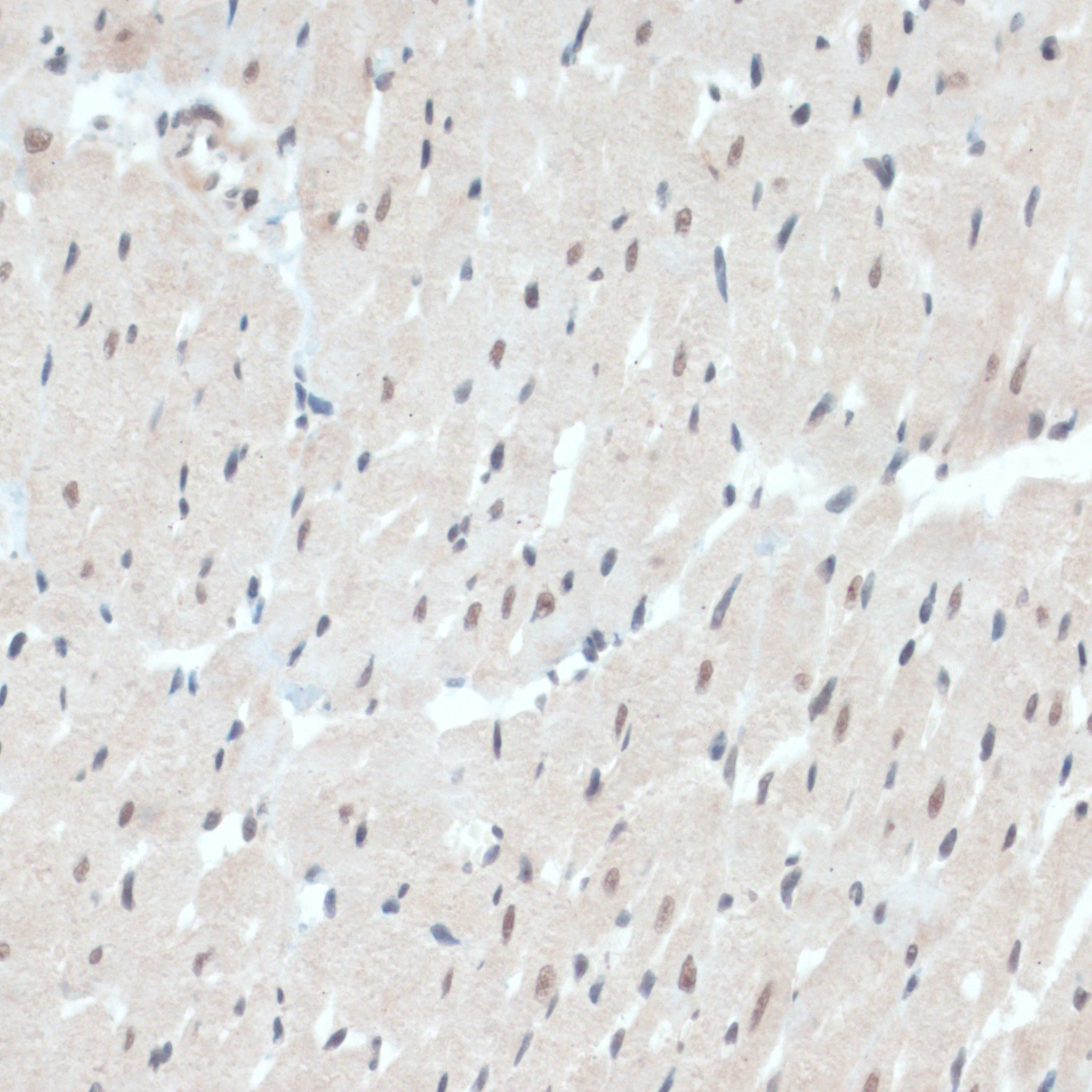 Anti-TXN Antibody (CAB14793)