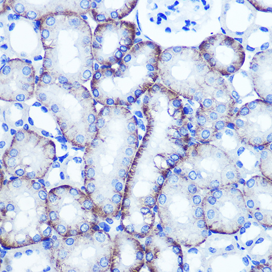 Anti-EXTL3 Antibody (CAB3857)