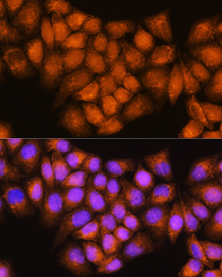 Anti-ARCN1 Antibody (CAB14993)