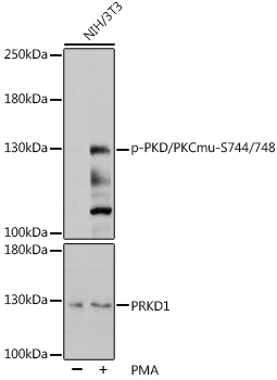 Anti-Phospho-PKD/PKCmu-S744/748 Antibody (CABP0534)