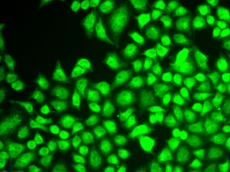 Anti-NFKB1 Antibody (CAB11160)