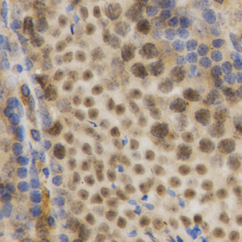 Anti-HuR / ELAVL1 Antibody [KO Validated] (CAB1608)