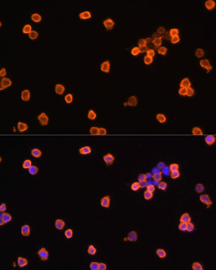 Anti-EEF1A1 Antibody (CAB17857)