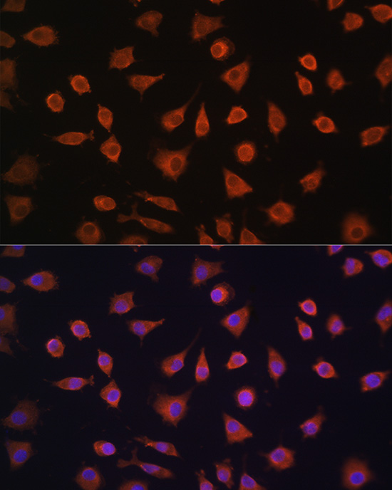 Anti-PFKFB2 Polyclonal Antibody (CAB9311)