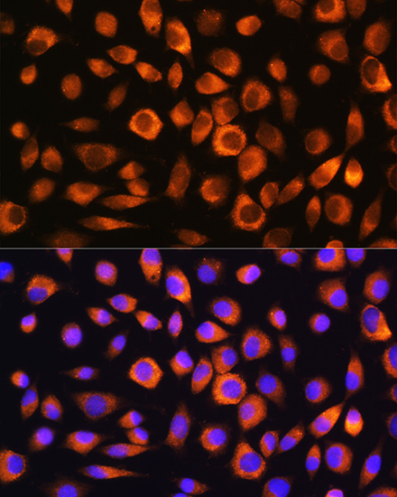 Anti-Hsc70 Antibody (CAB2487)