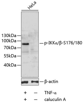Anti-Phospho-IKK alpha/beta-S176/180 Antibody (CABP0546)