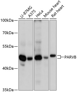 Anti-PARVB Antibody (CAB13161)