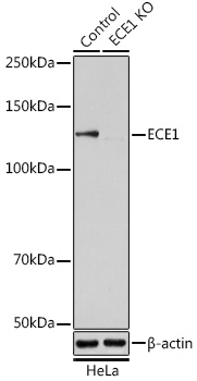 Anti-ECE1 Antibody [KO Validated] (CAB5638)