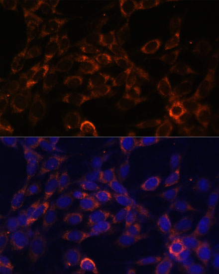 Anti-USE1 Antibody (CAB13151)