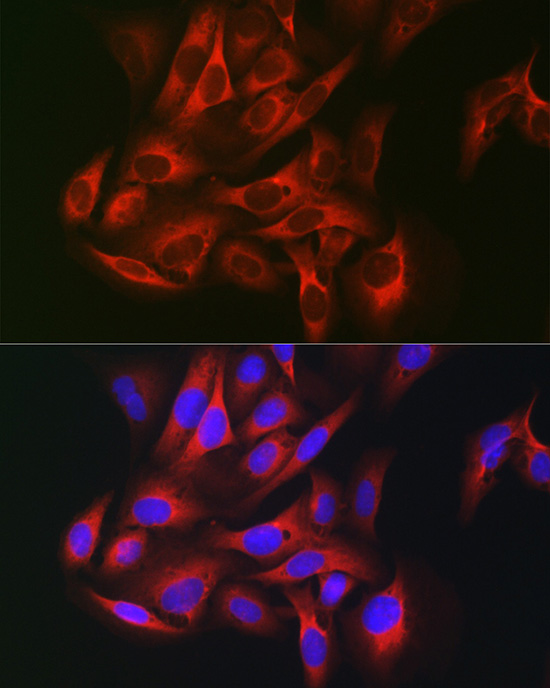 Anti-KEAP1 Antibody (CAB1820)