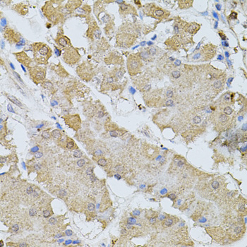 Anti-BEST1 Antibody (CAB3022)