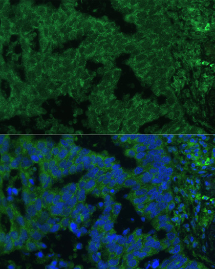 Anti-Interleukin-25 Polyclonal Antibody (CAB8252)