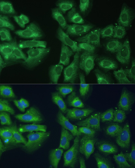 Anti-EIF3D Antibody (CAB5947)