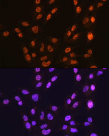 Anti-CTCF Antibody [KO Validated] (CAB19588)