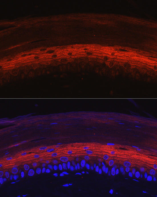 Immunofluorescence analysis of rat skin using KRT80 Rabbit pAb at dilution of 1:50 (40x lens). Blue: DAPI for nuclear staining.