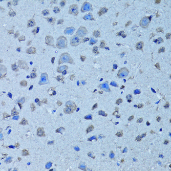 Anti-CD55 Antibody (CAB13918)