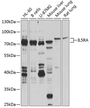 Anti-IL5RA Polyclonal Antibody (CAB8552)