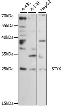 Anti-STYX Antibody (CAB15320)