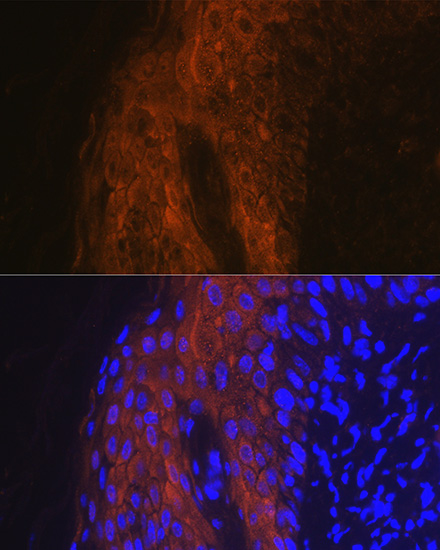 Anti-IL-1RN Antibody (CAB2088)