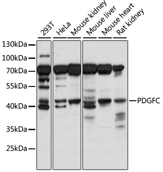 Anti-PDGFC Antibody (CAB15174)