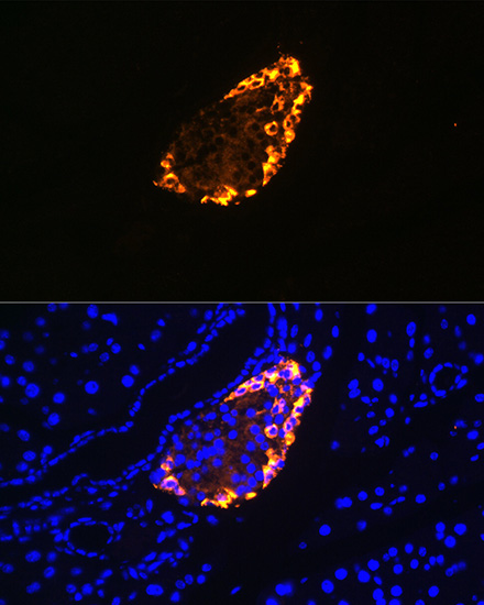 Anti-Somatostatin Polyclonal Antibody (CAB9274)