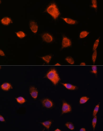 Anti-NUMB Polyclonal Antibody (CAB9352)