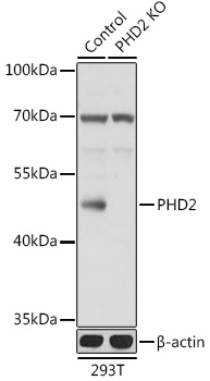 Anti-PHD2 Antibody [KO Validated] (CAB14557)