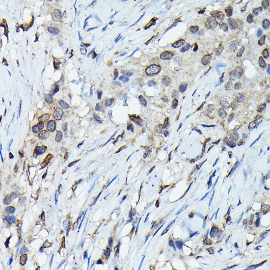 Anti-C9orf72 Antibody (CAB15970)