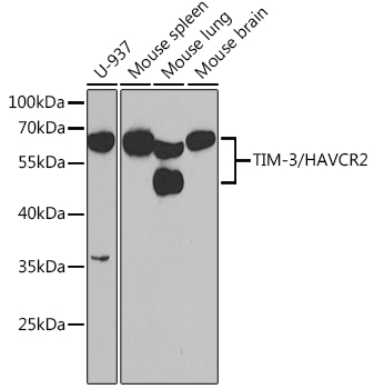 Anti-TIM-3/HAVCR2 Antibody (CAB2516)