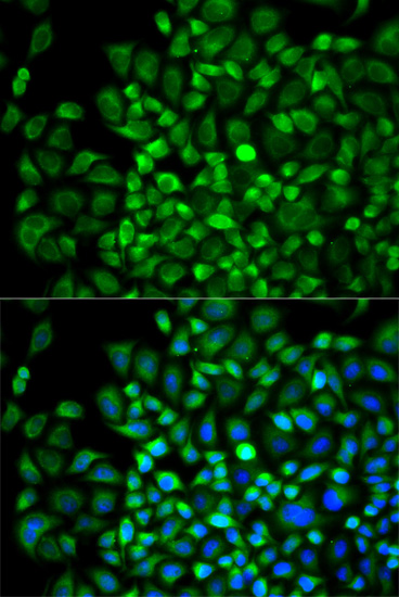 Anti-ANGPTL4 Antibody (CAB13425)