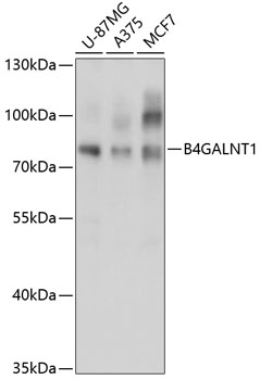 Anti-B4GALNT1 Antibody (CAB3874)