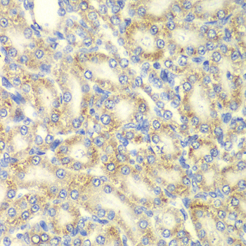 Anti-PRKAB2 Antibody (CAB6952)