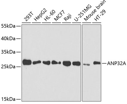 Anti-ANP32A Antibody (CAB5768)