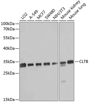 Anti-CLTB Polyclonal Antibody (CAB8404)