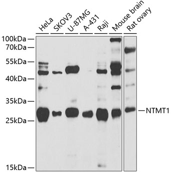 Anti-NTMT1 Antibody (CAB7098)