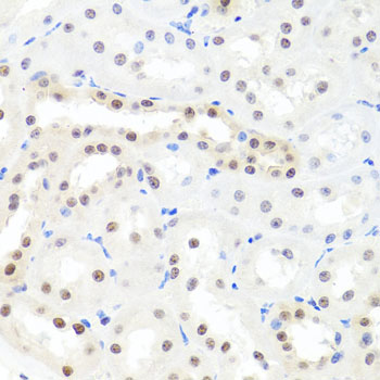 Anti-HNRNPCL1 Polyclonal Antibody (CAB8606)