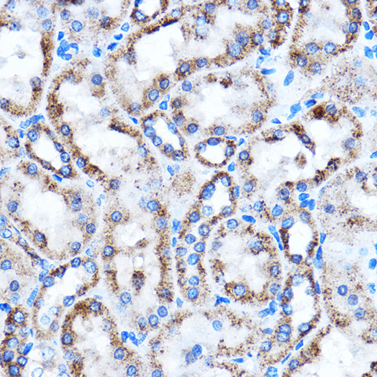 Anti-CTGF Antibody (CAB11456)